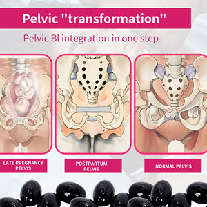 Cuidado privado ginecológico, estrechamiento pélvico, cápsula <span class=keywords><strong>cerrada</strong></span>, producto de cápsula de reparación pélvica - Product Image 3