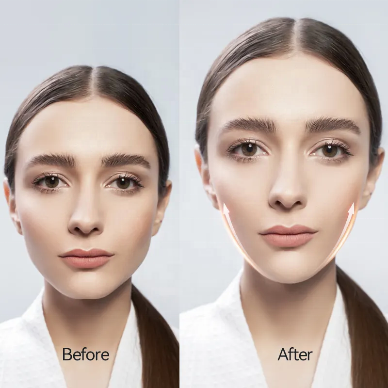 ORANGLES V-Shape Face Lift Massager | EMS Microcurrent Double Chin Eliminator & Jawline Toner | USB Rechargeable ABS/Stainless Steel – orangles Kuwait - elegant presentation - exhibiting components - Image 6 of 6 | ideal for home | Discount on V-Shape Face Lift Massager | EMS Microcurrent Double Chin Eliminator & Jawline Toner | USB Rechargeable ABS/Stainless Steel – orangles Kuwait Virginia | Free Shipping ORANGLES