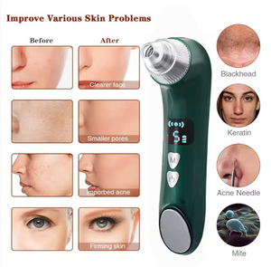 Nettoyeur de pores du <span class=keywords><strong>visage</strong></span>, outil électrique d'aspiration sous vide <span class=keywords><strong>pour</strong></span> éliminer <span class=keywords><strong>les</strong></span> points noirs, l'acné, <span class=keywords><strong>les</strong></span> imperfections et <span class=keywords><strong>les</strong></span> <span class=keywords><strong>boutons</strong></span> - Product Image 3