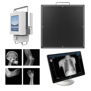 Careray Medical Mammography 14 X 17 Rayos X Detector De Panel Plano X Ray Machine Price