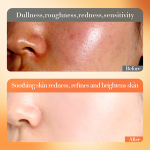 OEM ODM FAYANKOU Tonique éclaircissant à la vitamine C, texture rafraîchissante, antioxydant, hydratant pour le visage - Product Image 5