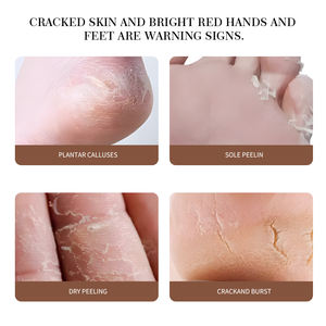<span class=keywords><strong>Crema</strong></span> para el Cuidado de los Pies para Talones Agrietados, Exfoliante, Anti-Grietas, Elimina la Piel Muerta, Repara y Blanquea los Pies con <span class=keywords><strong>Urea</strong></span> - Product Image 6
