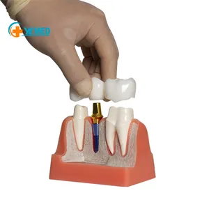 Modelo de ensino dental, preço de fábrica, alta qualidade, modelos de ensino, recursos, fonte, 4 vezes, maior, modelo de ensino de anatomia dental