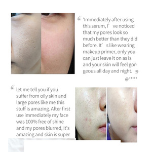 Sérum Offres Spéciales réduisant les points noirs minimisant les grands pores pour la peau du visage sérum essentiel Anti-acné anti-huile lisse - Product Image 6
