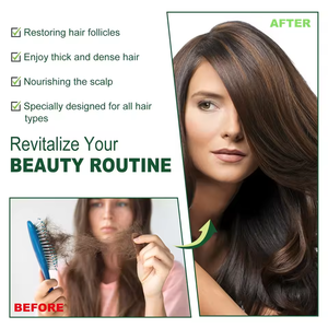 Olio di Enotera 100% Naturale Biologico per la Cura della Pelle Idratante per Neonati Olio di Semi di Enotera per Massaggi Corpo - Product Image 5