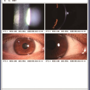 เครื่องมือตรวจตา ออฟทัลโมสโคป ตรวจอาการตาแห้ง เมย์โบกราฟี DEA800 - Product Image 4