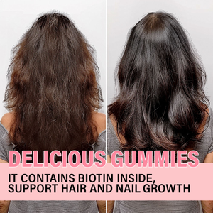 Gummies de collagène multi-vitaminées à marque privée OEM/ODM pour la beauté des cheveux, de la peau et des ongles, soutien anti-rides pour adultes - Product Image 5