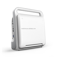 Máquina de ultrasonido Doppler cardíaco de gran oferta con sonda de matriz en fase para uso cardíaco