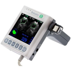 Escáner de Vejiga Inalámbrico Portátil Visbull BVT-02 con Certificación CE, Diseño Digital de Mano de Fácil Operación para Uso Clínico - Product Image 2