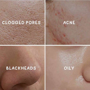 Nieuwkomers Natuurlijke Organische Moddermasker Olie Controle Diepe Reiniging Wegwerp <span class=keywords><strong>Capsules</strong></span> Groene Thee Rose Custom Logo Gezicht Klei Masker - Product Image 5