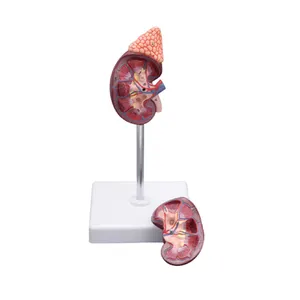 Modelo de Riñón Humano de PVC de Alta Calidad, 2 Partes, Tamaño Natural - Product Image 1