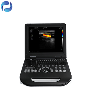 휴대용 컬러 도플러 초음파 진단기 의료기기 임신 진료용 초음파 장치 3년 보증 - Product Image 2