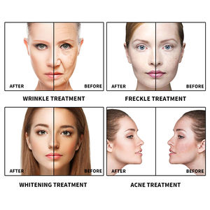 เครื่องเพิ่มความชุ่มชื้นให้ผิวหน้าด้วยออกซิเจนหัวฉีดแรงดันสูงเครื่องสร้างความชุ่มชื้นให้<span class=keywords><strong>ผิว</strong></span>หน้ารักษาผิวด้วยเจ็ทลอกผิว - Product Image 4