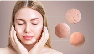 Grado cosmético CAS 84380-01-8 Polvo de Arbutina blanqueadora de piel pura Alfa-arbutina - Product Image 6