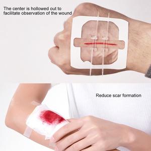 Tiras quirúrgicas para heridas, dispositivo de cierre para heridas, indicado para cerrar heridas agudas, como laceraciones e incisiones quirúrgicas - Product Image 3