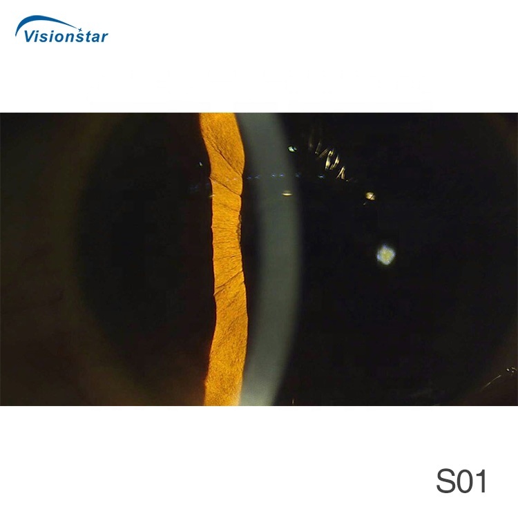 Portable Slitlamps - High Quality Ophthalmic Equipment