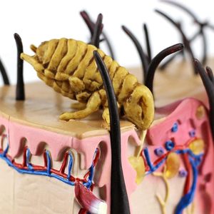 Modelo Educativo de Piel <span class=keywords><strong>Humana</strong></span> con Irritación por Agua y Pústulas, Modelo Anatómico de Piel <span class=keywords><strong>Humana</strong></span> para Ciencias, CE/ISO - Product Image 4