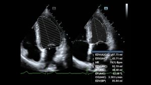 Mesin USG Mindary DC-60 DC-70 DC-80 dengan Pencitraan 4D untuk Hewan Kecil, Hewan, Manusia, dan Kehamilan - Product Image 6
