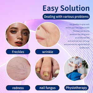 980ポータブルクモ血管除去機980nmダイオードレーザー980nm - Product Image 3