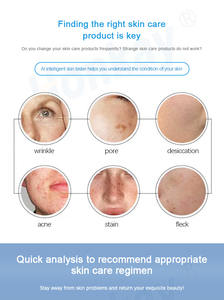 Análise facial mágica da pele do analisador do cancro da pele umidade umidade do analisador 3d pele do espelho