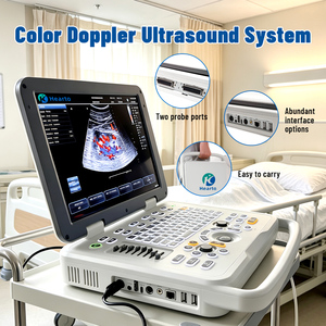 Ecógrafo Portátil Doppler Color, Escáner <span class=keywords><strong>de</strong></span> Diagnóstico Médico para Hospitales, Clínicas, Obstetricia y Ginecología - Product Image 3