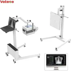 Vendas diretas de fábrica em preços baixos 5kw x ray mobile x-ray da máquina para radiologia