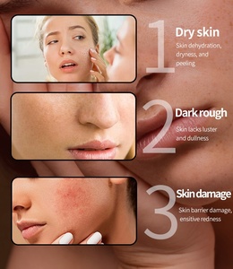 Sabonete De Banho Artesanal De Boa Qualidade Para Clareamento Da Pele Com Extrato De Cereja, Ácido Kójico E Glutationa, Antiacne E Clareador Facial - Product Image 5