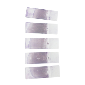 Huyết học chuẩn bị Slide máu smear cấp tính promyelocytic bệnh bạch cầu M3 APL - Product Image 4