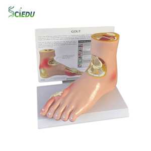 Modelo de Órgano Objetivo para la Complicación de Enfermedades por Azúcar, Modelo de Modelo Patológico de Hipertensión del Pie con Piedra del Viento y Modelo de Articulación del Pie - Product Image 1