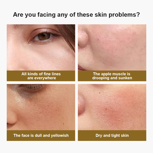 Корейский высококачественный лосьон для лица, тела, 50 мл, увлажняющий крем с церамидом скваланом для сухой кожи, ночной крем для отбеливания - Product Image 5