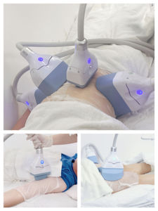 Máquina de Adelgazamiento Portátil S10 Cryocare con Dos Manijas - Product Image 5