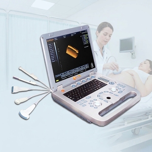 Ecógrafo Digital Portátil de 15 Pulgadas, Ecógrafo 2D 3D 4D en Blanco y Negro para Uso Hospitalario - Product Image 1