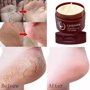 <span class=keywords><strong>Crème</strong></span> pour les mains et les pieds à l'huile de cheval, best-seller, répare rapidement les pieds gercés, élimine les peaux mortes et exfolie, en stock, 120g - Product Image 2