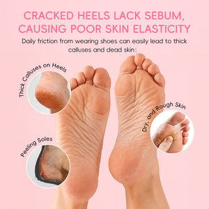 LAIKOU JAPON <span class=keywords><strong>SAKURA</strong></span> Vente en Gros Crème Anti-Crevasses Talons Très Secs 40g, Bâtonnet Hydratant Intense pour Soin des Pieds Rugueux - Product Image 4