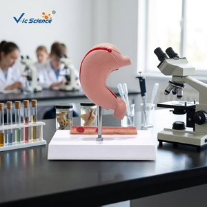 Modèle d'ulcère gastrique et de perforation : Montre l'évolution de la gastrite à l'ulcère perforant pour l'enseignement médical et la formation en pathologie - Product Image 1