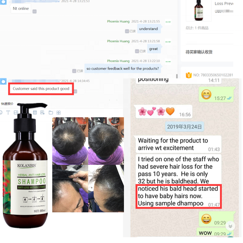 Частная торговая марка производителей шампунь для восстановления роста волос от выпадения волос Уход Лечение 300 мл оптовая продажа продукта