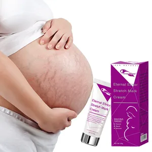 Hot selling good effective scars and stretch marks removal cream private label low quantity customize