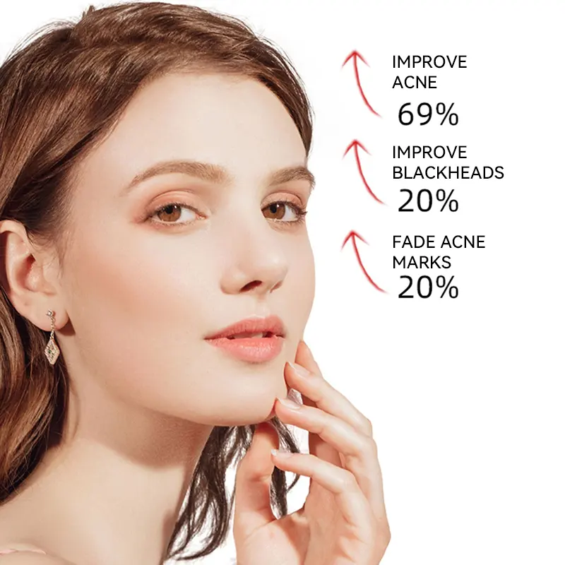 Enjoy Skin Private Label AHA BHA Peeling Solution Face Serum Anti Acne Exfoliate Renew Face Skin Factory Price