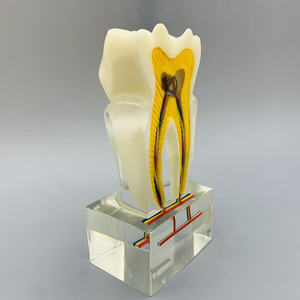 نموذج الفم 6 مرات نموذج عصب الأسنان مع تشريح الأعصاب للتعليم والعرض - Product Image 5