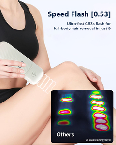 Appareil d'<span class=keywords><strong>épilation</strong></span> IPL KCA511 avec filtre UV, sûr pour la maison, <span class=keywords><strong>épilation</strong></span> permanente avec capteur cutané - Product Image 4