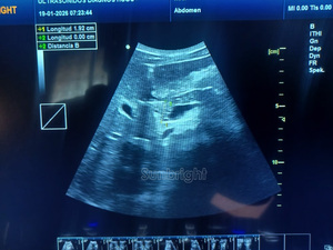 Ecógrafo <span class=keywords><strong>Doppler</strong></span> color portátil de alta calidad con sondas convexas y lineales - Product Image 4