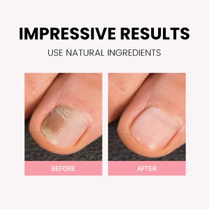 <span class=keywords><strong>Aceite</strong></span> para Cutículas Orgánico Personalizado al por Mayor con Aceites <span class=keywords><strong>de</strong></span> Jojoba, Argán y Coco, 5ml, con Pincel, Queratina Natural, Marca Privada, Cuidado <span class=keywords><strong>de</strong></span> Uñas - Product Image 2