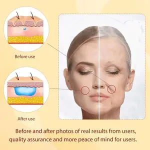 Korean PDO Thread Lift Ultra V Line 18g COG 3D 4D 6D W / L Blunt Cannula Face Lifting Thread For Face And Body