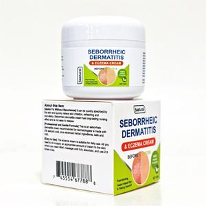 Marque privée, crème naturelle apaisante contre la dermatite séborrhéique pour le psoriasis, la folliculite, l'eczéma, le <span class=keywords><strong>cuir</strong></span> <span class=keywords><strong>chevelu</strong></span> sec et les pellicules - Product Image 1