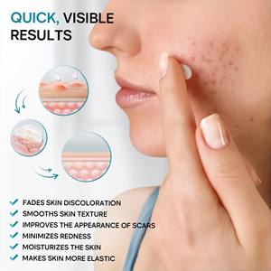 Removedor de cicatrices de acné de etiqueta privada Anti Vergeture Repair Productos de eliminación de cicatrices Crema de eliminación de cicatrices de acné fuerte y efectiva - Product Image 2