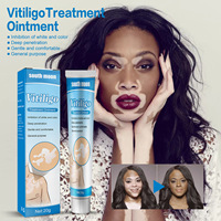 Crème Traitement du Vitiligo pour le Corps – Élimine les Taches Blanches, la Teigne, la Leucoplakie Cutanée, la Dermatite – Certifié Médical SGS Classe I