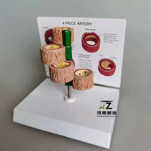 4 buah Model demonstrasi trombus arteri manusia sains medis Model penyakit manusia - Product Image 2