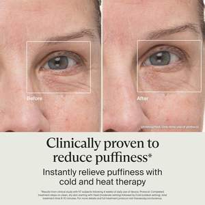 Therabody TheraFace Appareil de massage facial anti-poches à chaud et froid, outil de beauté en alliage de <span class=keywords><strong>chrome</strong></span>, rouleau facial, masseur pour les yeux, cernes - Product Image 4