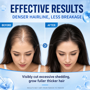 Private Label Peptide <strong>Hair</strong> Serum Biotin Rosemary Intensive <strong>Follicle</strong> <strong>Stimulation</strong> for Thinning <strong>Hair</strong> Strengthening Mist 60ml OEM - Product Image 2