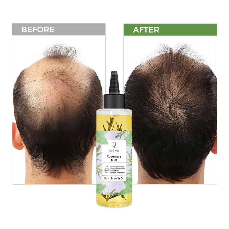 QQuaker Rosmarino-Haaröle für das Haarwachstum Öl für schwarze Frauen Eigenmarken-Haaröl